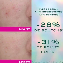 Zinc [pca]|Teint Unifié & Pores Resserreés|NUXE Sérum anti-imperfections anti-boutons - Trousse offerte